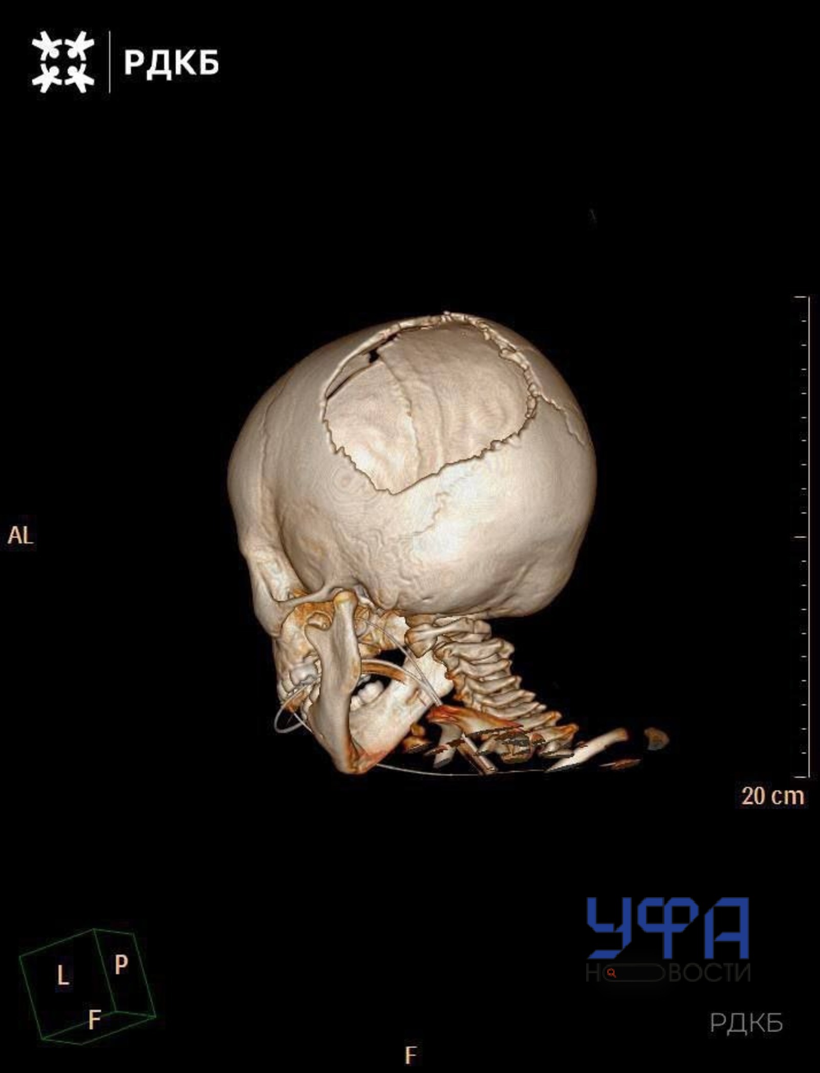 РДКБ ТГ-канал