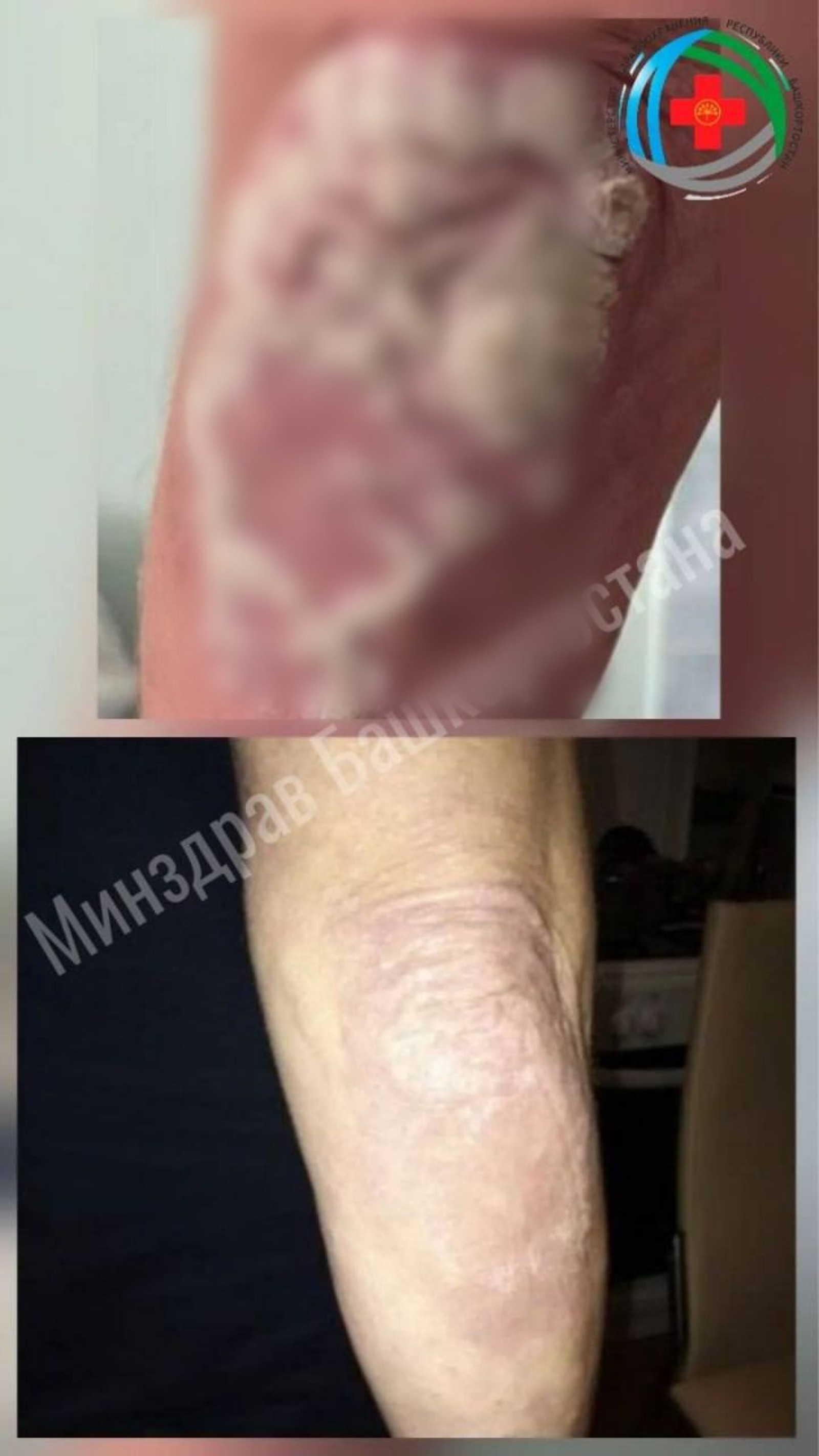 Минздрав Башкирии ТГ-канал