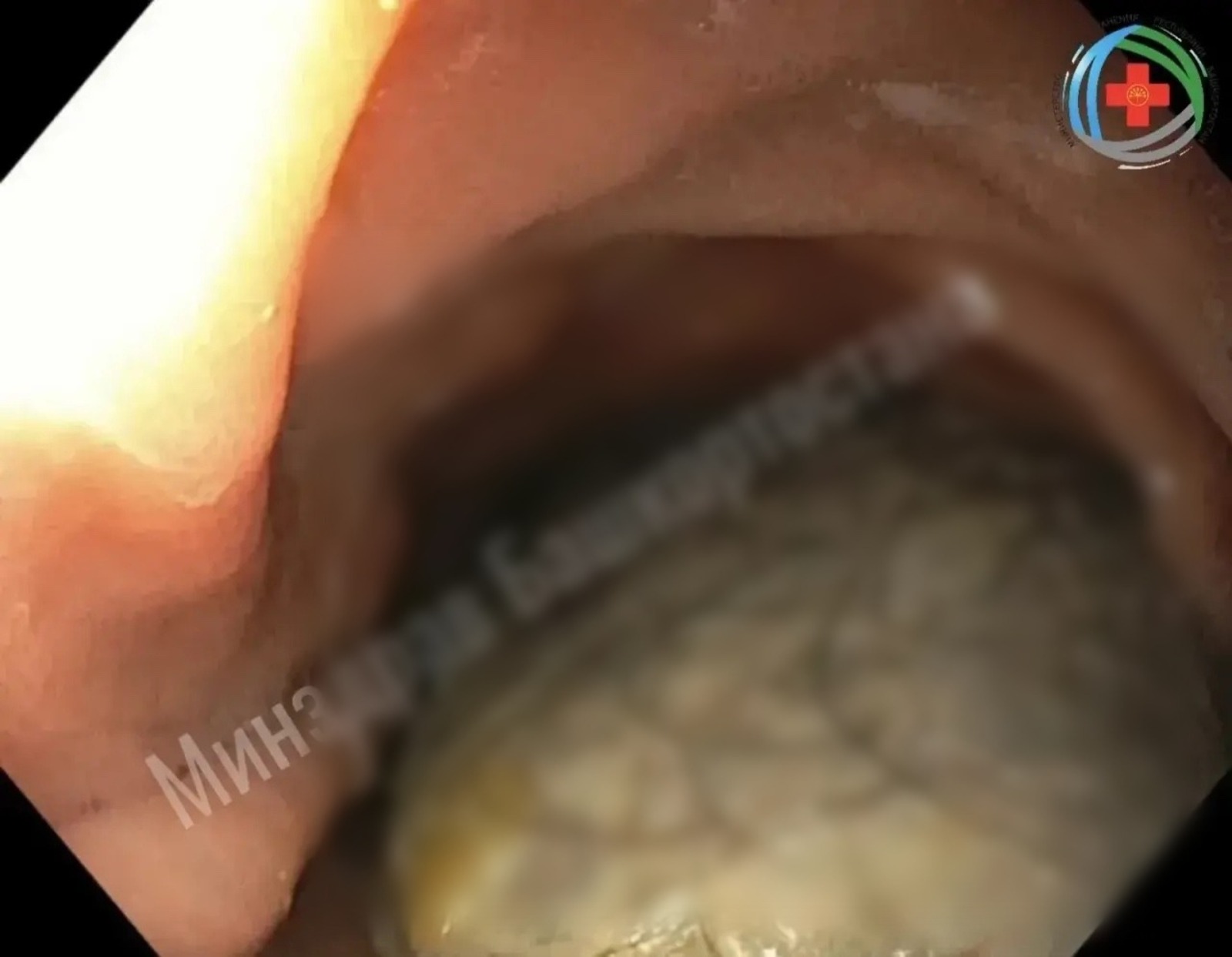 Минздрав РБ Пресс-служба