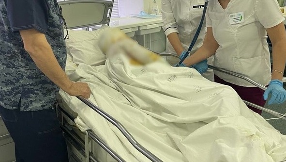 В Башкирии беременная женщина получила 50% ожогов тела при взрыве бытового газа