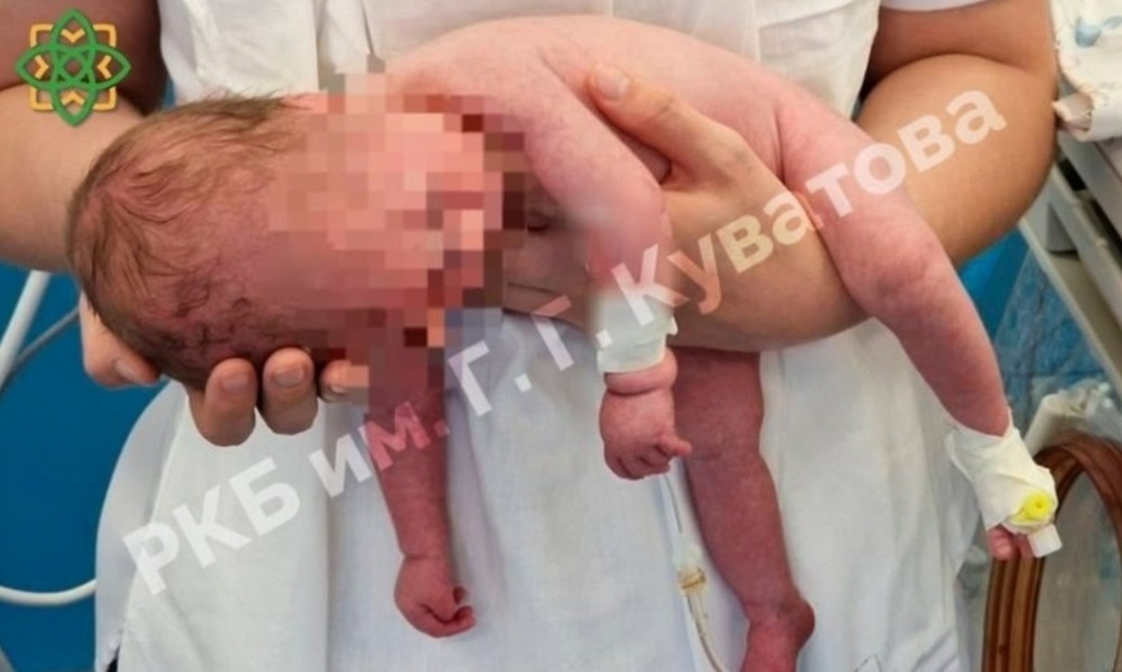 Фото: РКБ им. Куватова