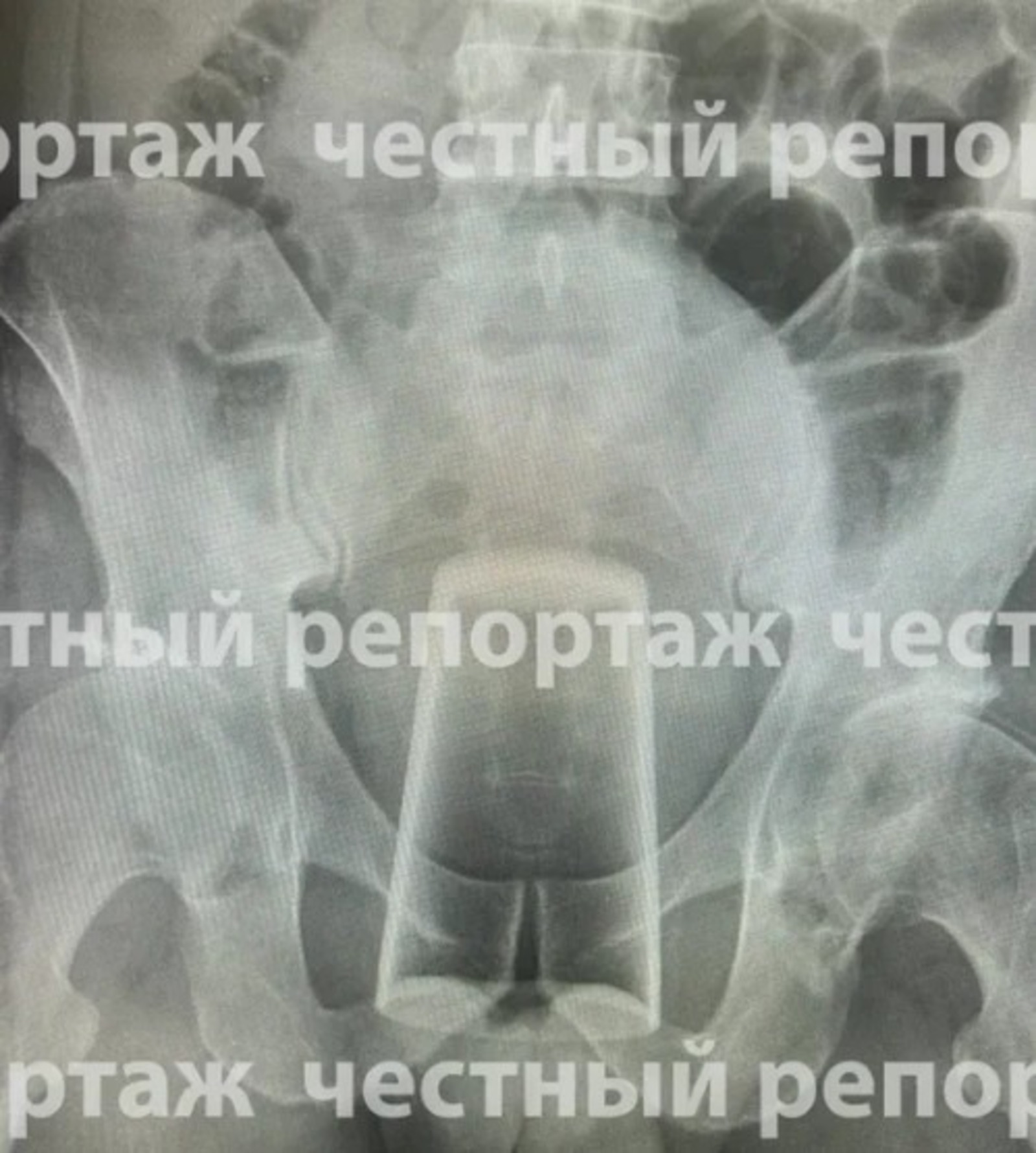 Честный репортаж ТГ-канал